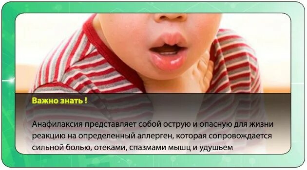 При ротовирусе цвет. Сыпь при ротовирусе у ребенка. ротавирусная инфекция у детей. ротавирусная инфекция у детей сыпь. сыпь при ротавирусной инфекции.
