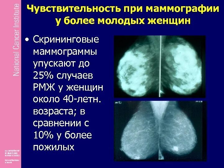 Маммография примеры описания. Маммография картинки. Хорошие Результаты маммографии. Маммография молочных желез заключение. Маммография периодичность