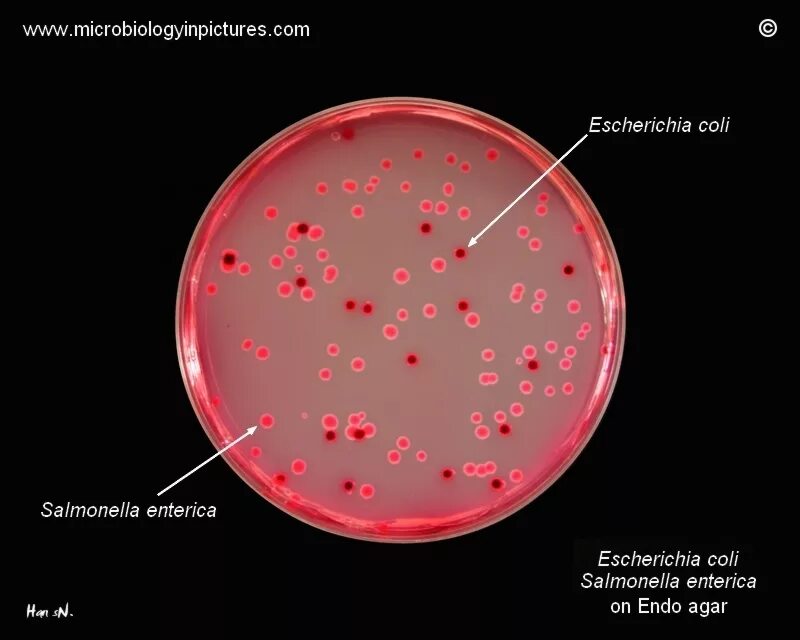 Coli sotwe. Escherichia coli на среде Эндо. Колонии сальмонелл на среде Эндо. Рост кишечной палочки на среде Эндо. Сальмонеллы в среде Эндо микробиология.