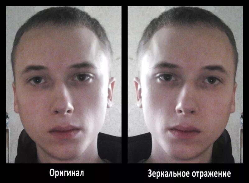 Зеркальная болезнь это. Зеркальная болезнь это