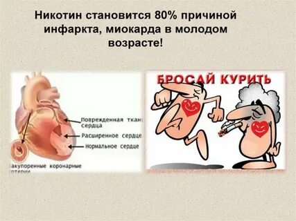 Почему вредно стоять