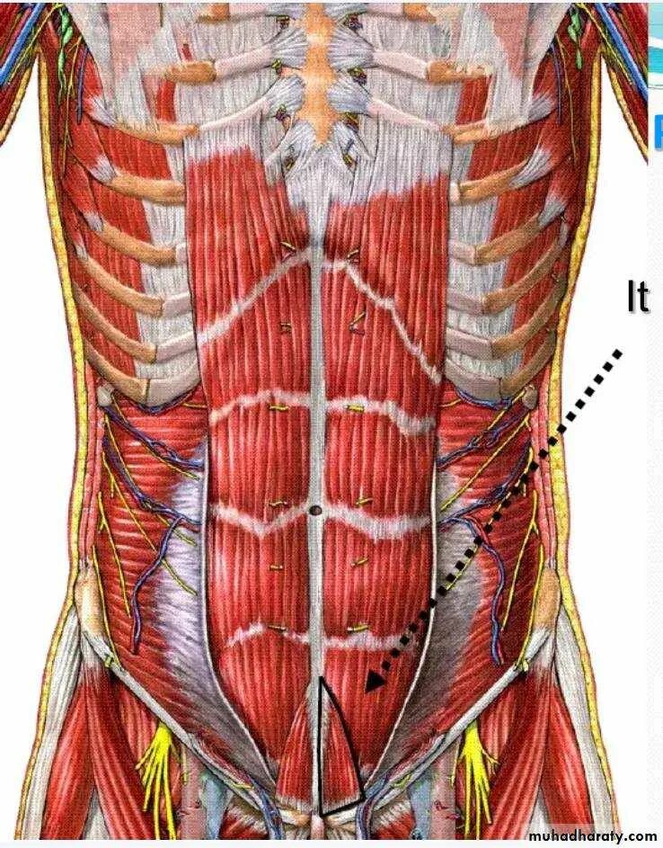 Пирамидальная мышца живота анатомия. Pyramidalis muscle анатомия. Rectus abdominis pyramidalis. Мускулюс Пирамидалис.