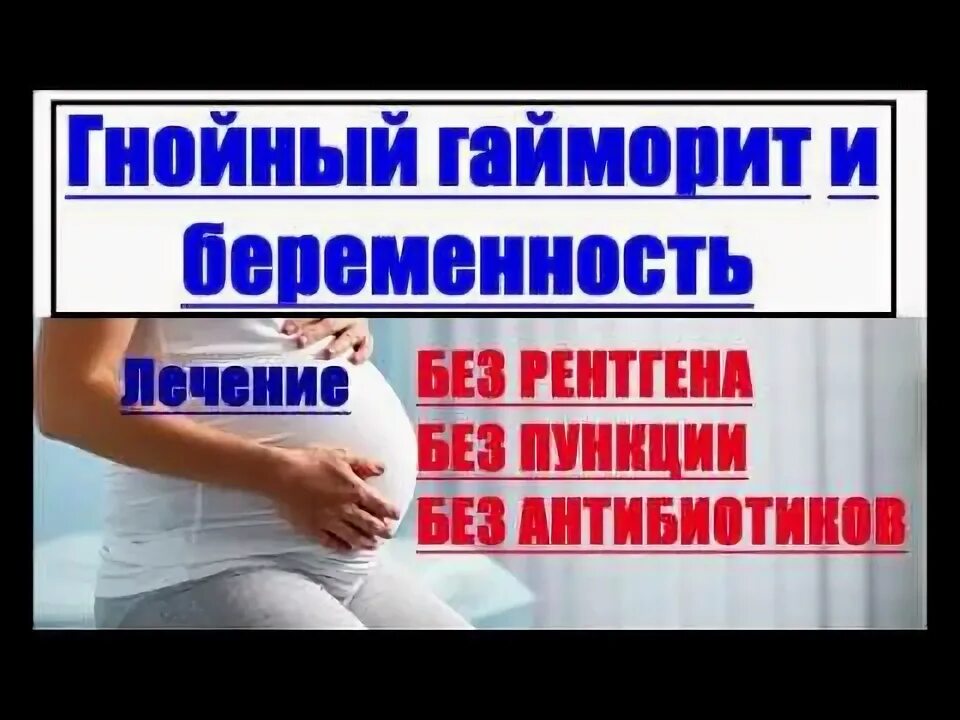 Лекарство от синусита и гайморита таблетки. Сосудосуживающие капли в нос для детей от 2 лет. Гайморин для беременных. Тонзилгон, синупрет, бронхо. Средства от синусита и гайморита у взрослых.