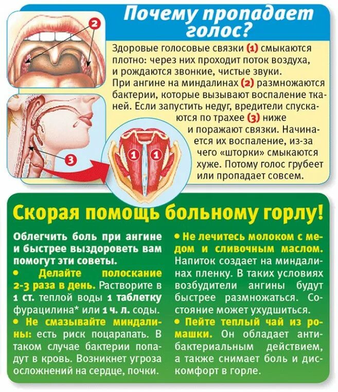 Чем лечить начинающее болеть горло. Народные средства от боли в горле. Лекарство для горла для детей. Средство от больного горла. Капсулы от боли в горле.