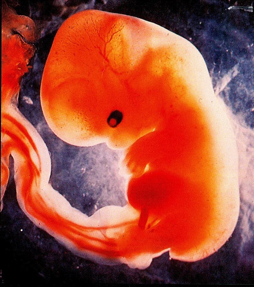 Плод ребенка. Эмбрион на 8 неделе беременности.