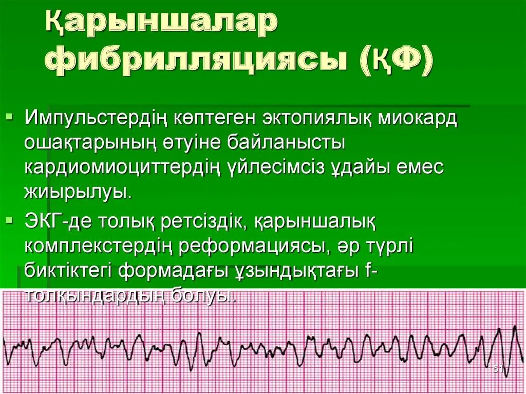 Тахисистолия это. Инфаркт миокарда ЭКГ фибрилляция 'желудочков. Пароксизм фибрилляции желудочковов ЭКГ. Трепетание желудочков на ЭКГ. Трепетание и фибрилляция желудочков на ЭКГ.