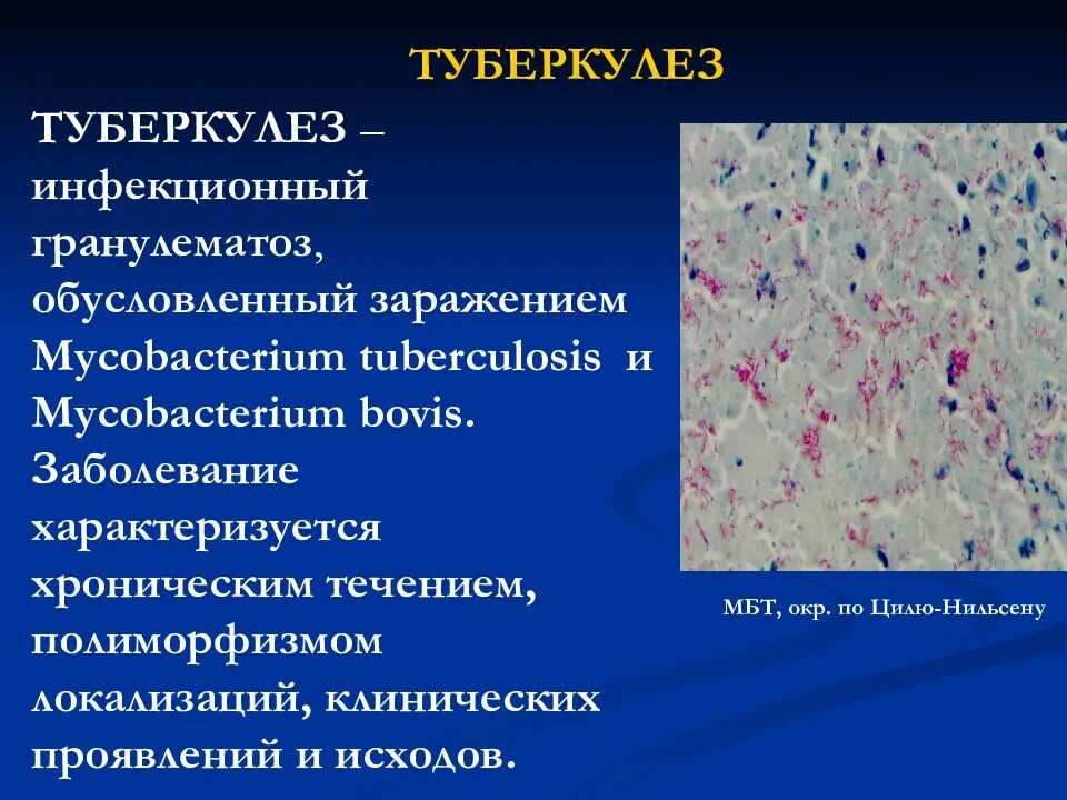 Туберкулез это. Классификация туберкулеза патологическая анатомия. Патологическая анатомия туберкулеза. Классификация туберкулеза патанатомия. Туберкулез. Сифилис. Патанатомия.