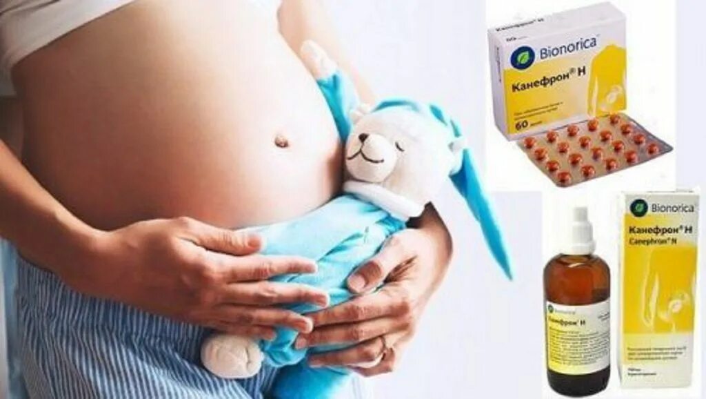 Для чего назначают беременным таблетки. Канефрон для беременных в таблетках. Канефрон таблетки при беременности 3. Монуфрон при беременности. Лекарство от почек для беременных.