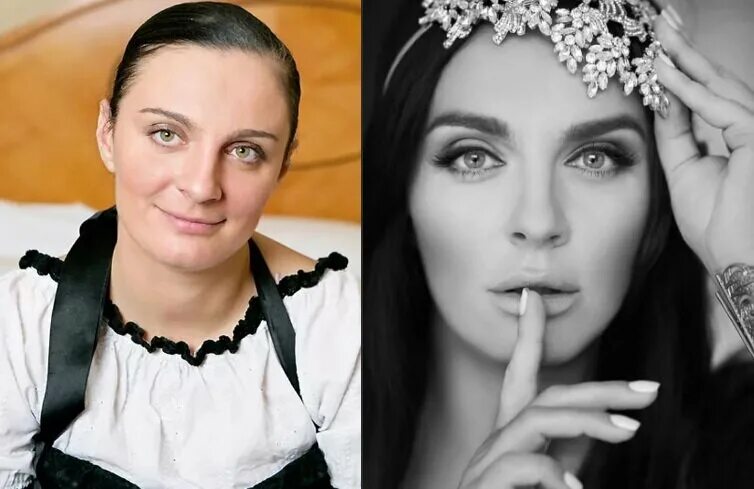 Ваенга фото до и после пластики фото - DgPhoto.ru
