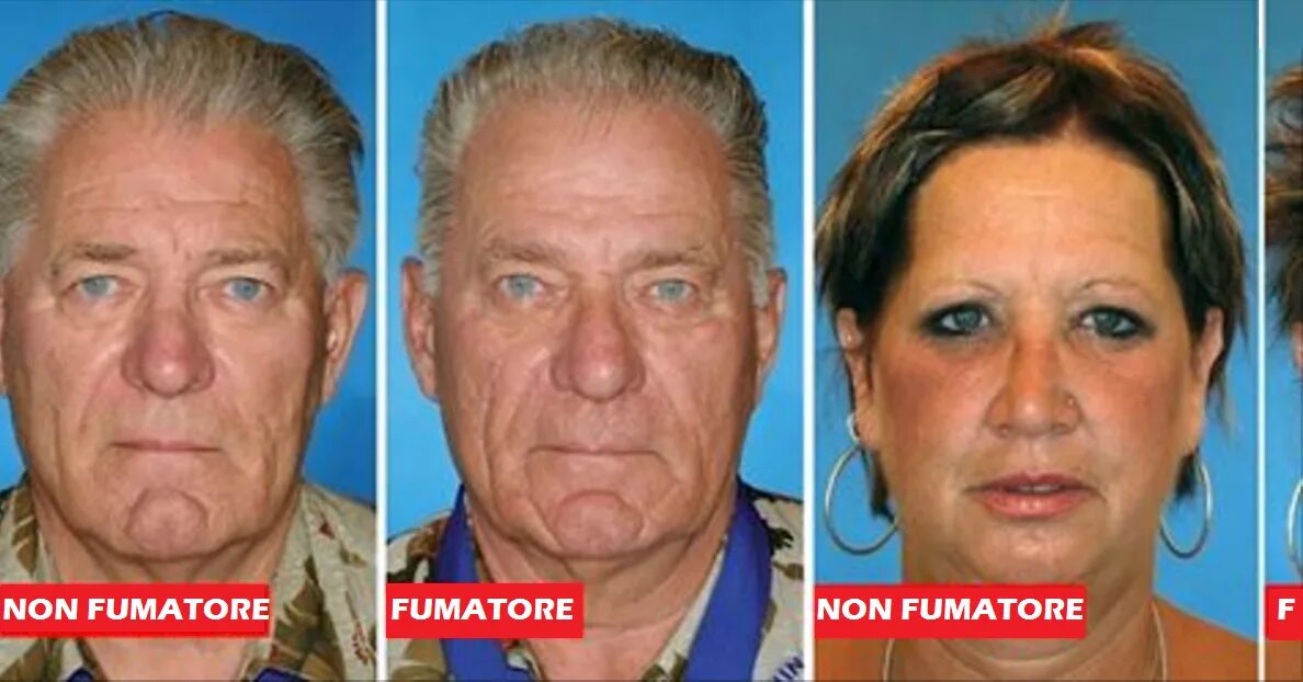 This Is How Your Face Changes After 30 Days of Drinking Water Sağlık, Cilt, Sağl