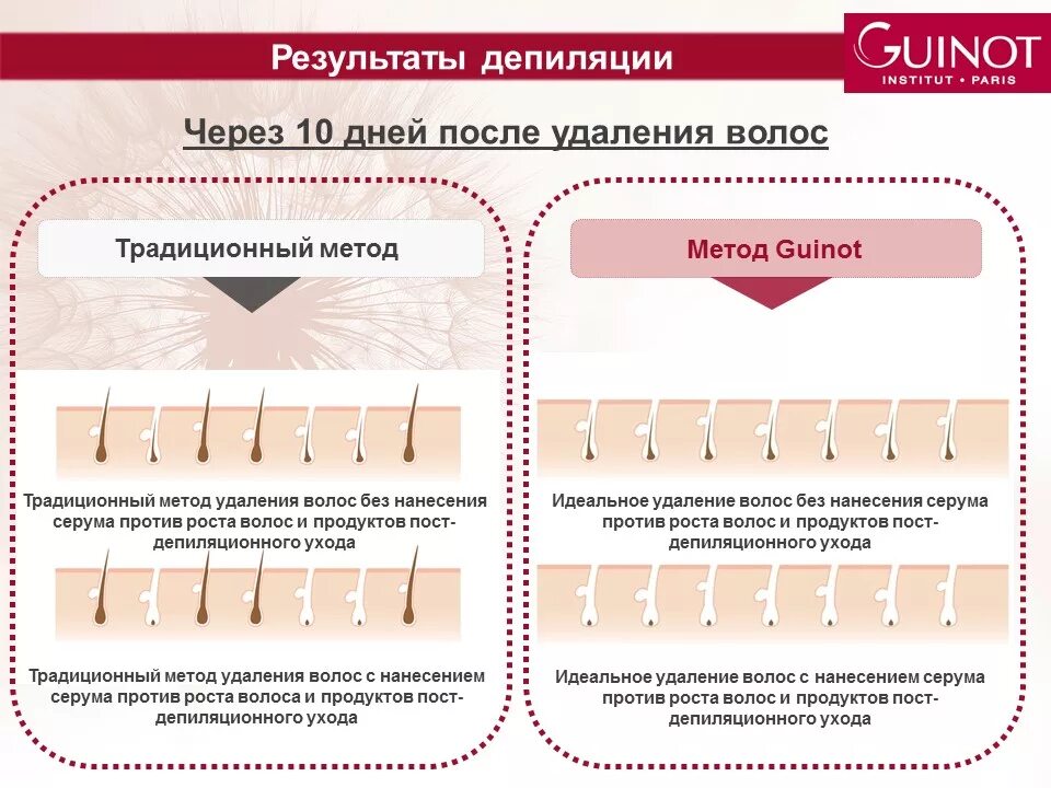 После ухода времени. Эпиляция плакаты. Зоны эпиляции. Плакаты про депиляцию. Плакат лазерная эпиляция.