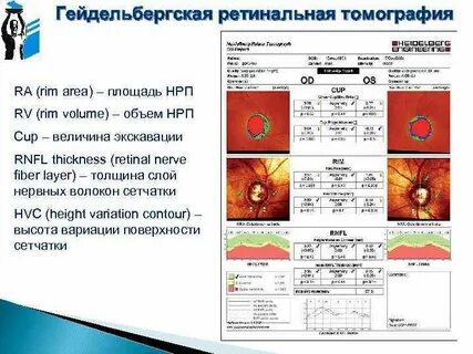 Hrt обследование глаз