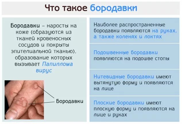 Папиломы вирус передается от человека к человеку. Разновидности бородавок. Причины появления бородавок.