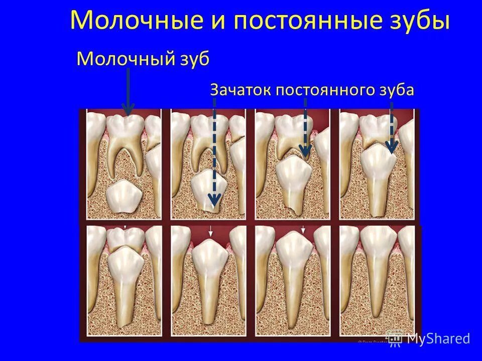 Выпал зуб без корня. Корень зуба молочного и постоянного. Длинные корни у молочных зубов.