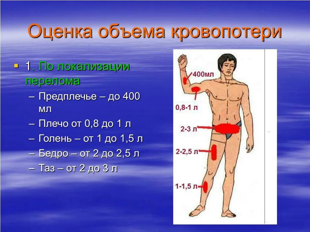 Острая кровопотеря объем. Критическая кровопотеря. Кровопотеря предплечья.