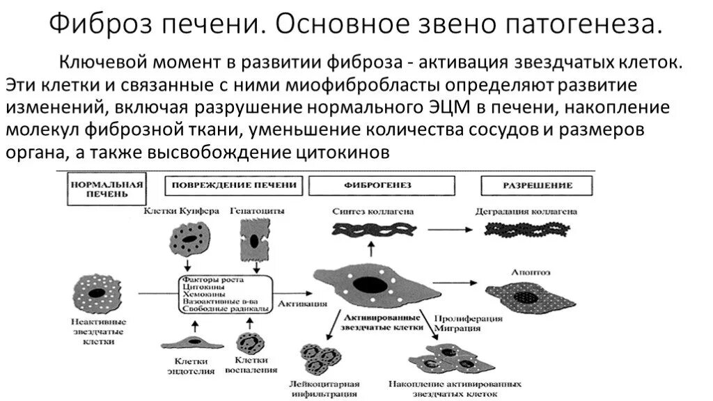 Сколько живут фиброзом 4. Механизм развития фиброза печени. Патогенез фиброза печени. Алкогольная энцефалопатия патогенез.