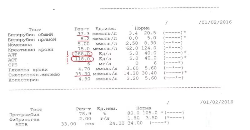 Анализ крови показал проблемы с печенью. Алат при циррозе печени показатели. Показатели алат и АСАТ при циррозе печени. Анализ крови при циррозе алт и АСТ. Анализ крови при циррозе печени показатели крови.