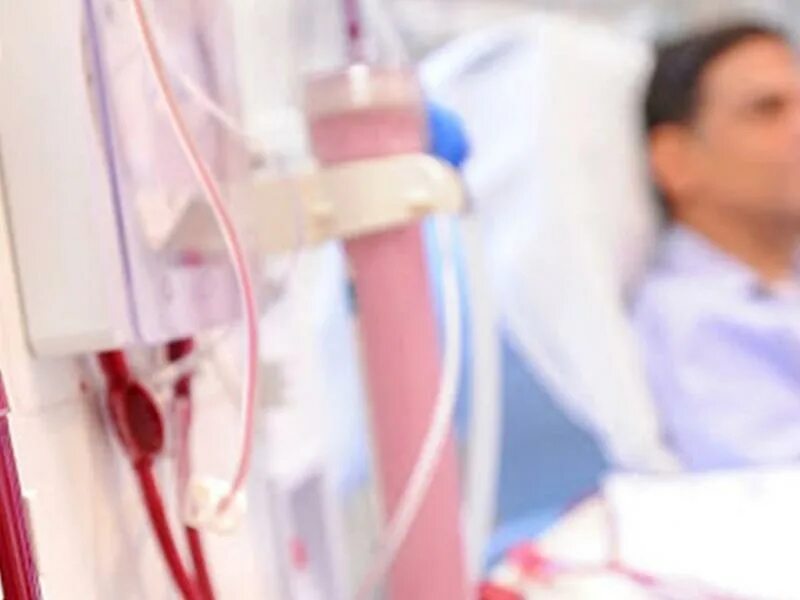 Плазмаферез и гемодиализ отличия. Процесс диализа. Аппарат для гемодиализ плазма. Гемодиализ b. Искусственная почка аппарат экмо.