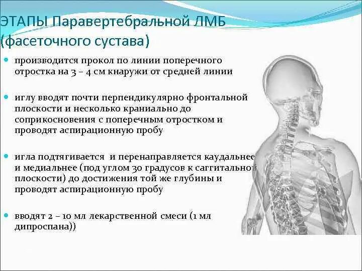 Последствия блокады позвоночника. Блокада фасеточных суставов шейного отдела. Техника проведения паравертебральной блокады. Техника выполнения паравертебральной блокады. Паравертебральная блокада поясничного отдела позвоночника.