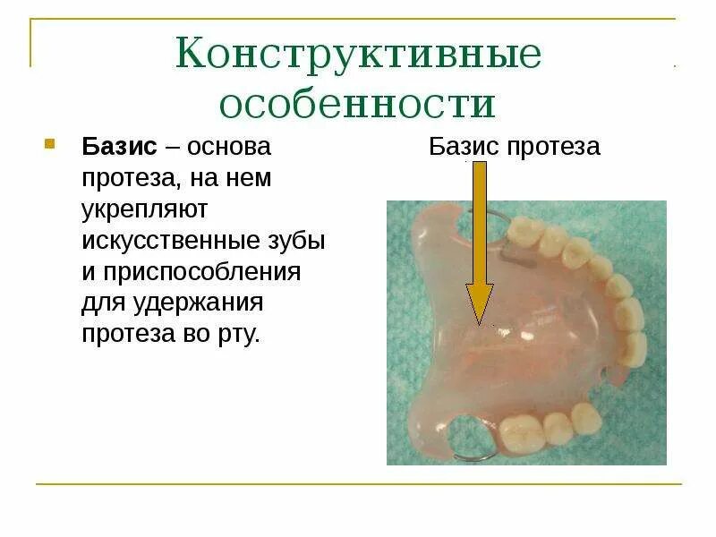 Естественный базис. Конструктивные элементы частичного съемного пластиночного протеза. Конструкционные элементы съемных пластиночных протезов. Конструктивные элементы съемных пластиночных протезов.