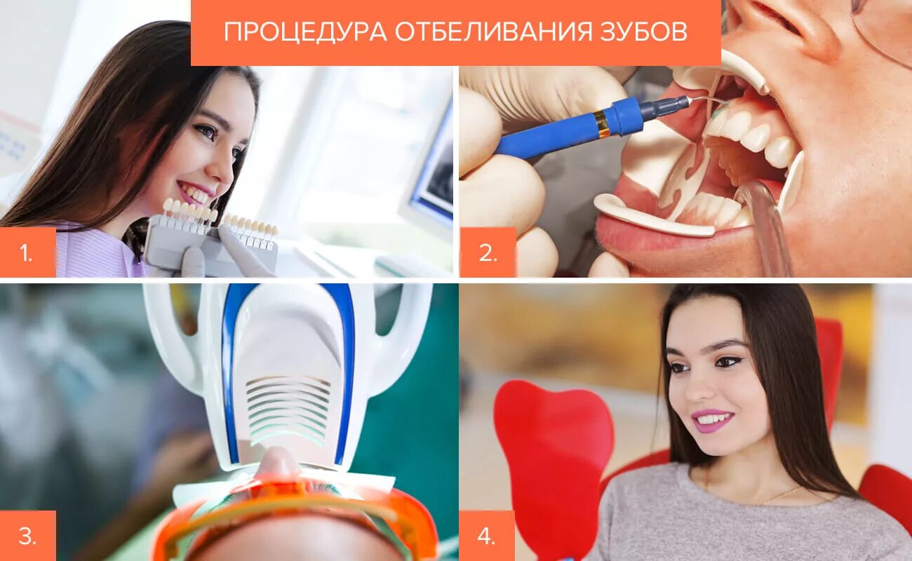 Процедура отбеливания зубов. Профессиональное отбеливание зубов. Этапы отбеливания зубов. Безопасное отбеливание зубов.