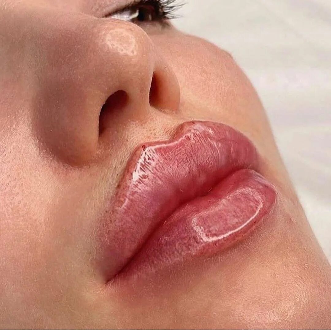 Форма губ бант. Форма губ бант