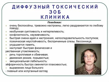 При диффузном токсическом зобе наблюдается