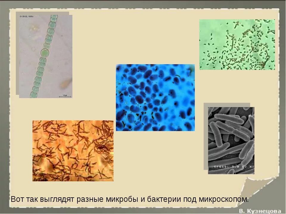 Как выглядит под названием. Бактерии в микроскопе. Бациллы бактерии под микроскопом. Разные микробы под микроскопом. Hcov-229e вирус под микроскопом.