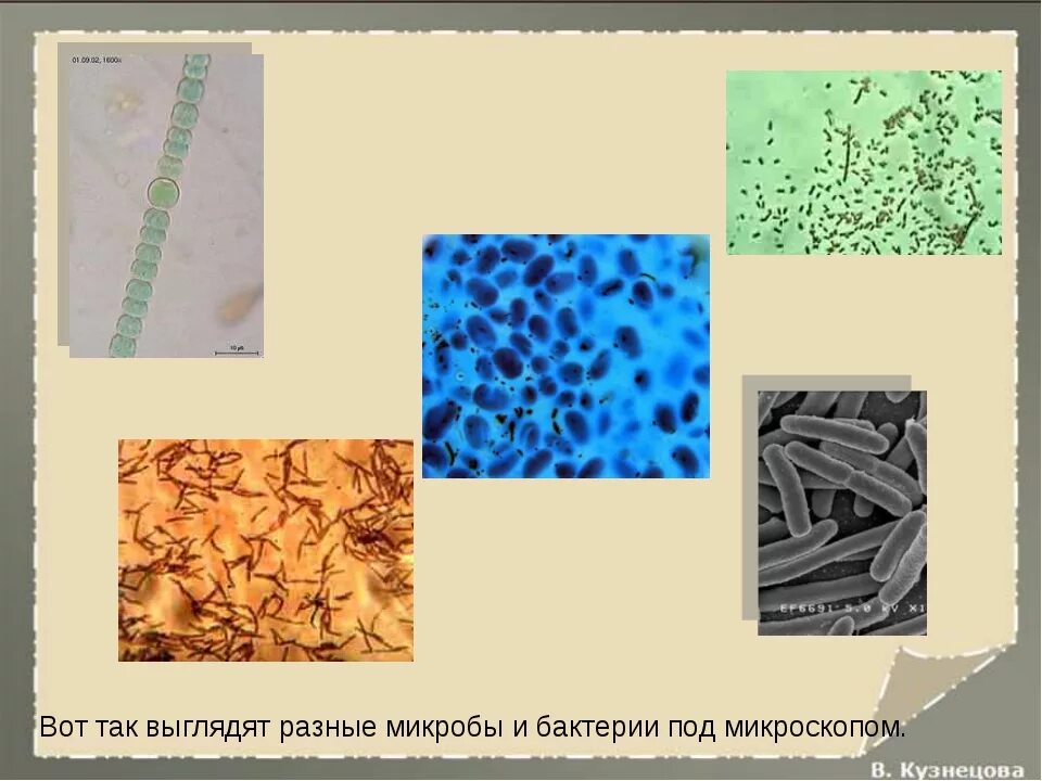 Большинство бактерий можно увидеть. Бактерии под микроскопом. Микроорганизмы под микроскопом. Разные микробы под микроскопом. Микробы и бактерии под микроскопом.