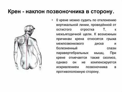 Наклоны позвоночника