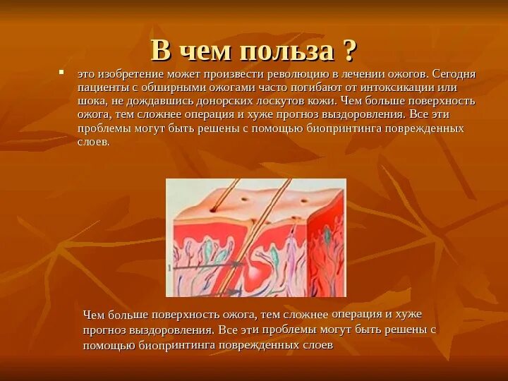 Методы лечения ожогов. Польза. ожоги хирургия презентация. лечение поверхностных ожогов.