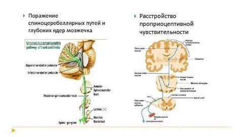 Миндалины мозжечка выше