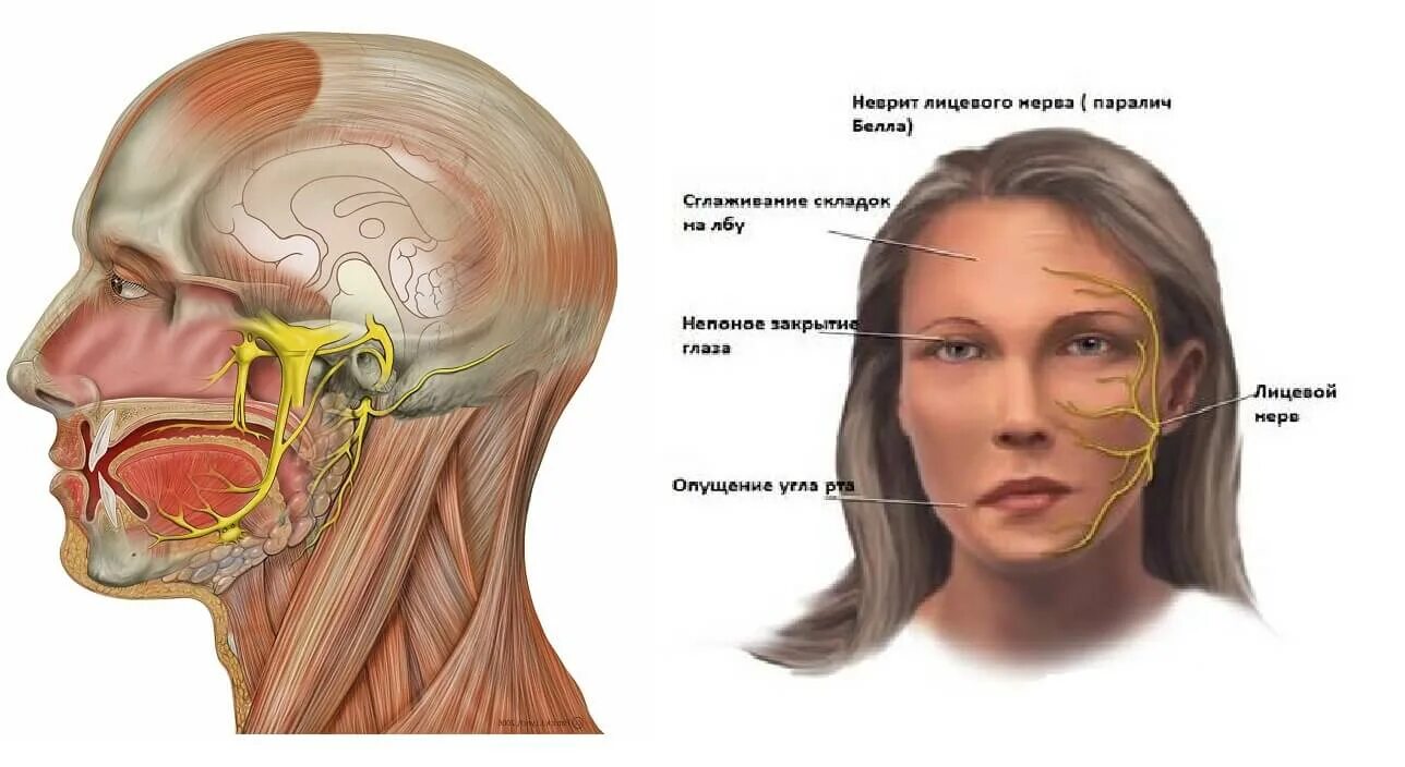 Лицевой нерв челюсти. Неврит воспаление нерва. Воспаление тройничного нерва. Неврит тройничного лицевого нерва. Неврит тройничного нерва лекарства.