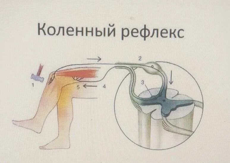 Схема рефлекторной дуги коленного рефлекса. Рефлекторная дуга коленного рефлекса. Рефлекторной дуги коленного рефлекса человека. Звенья рефлекторной дуги коленного рефлекса. Рефлекторная дуга коленного рефлекса человека последовательность