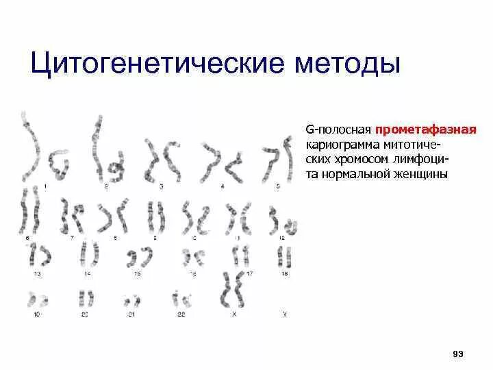 Число аутосом кариограмма женщины. Кариограмма хромосом. Кариограмма синдрома Эдвардса. Цитогенетический метод диагностики наследственных болезней. Цитогенетический метод наследственные заболевания