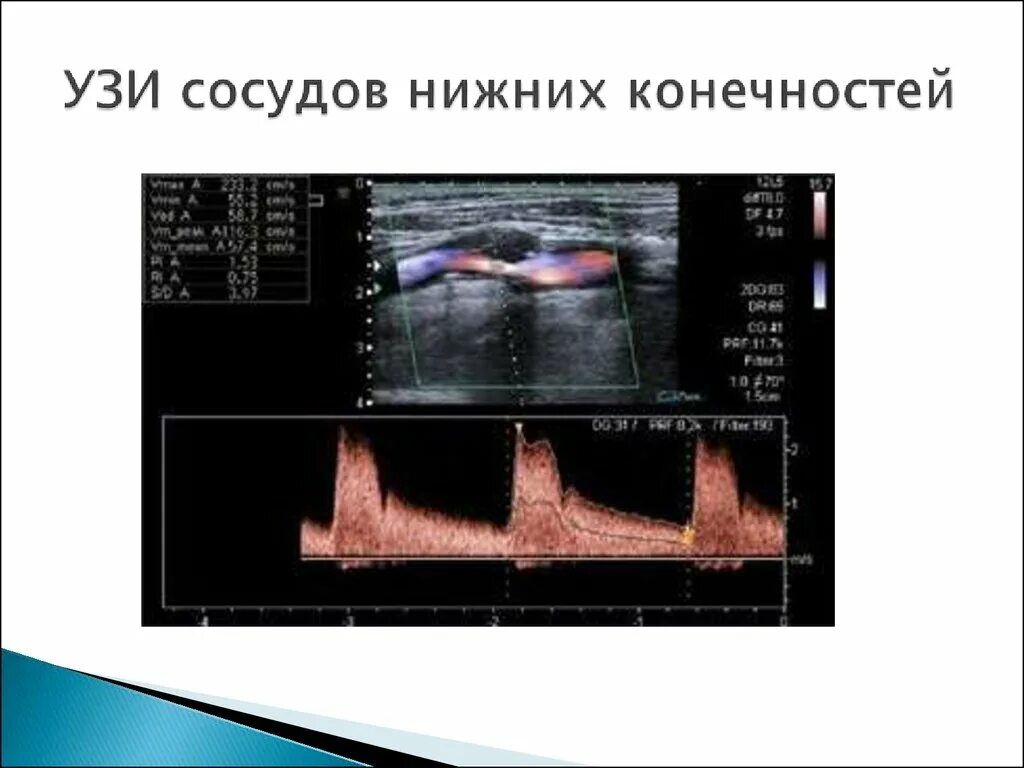 Узи нижних конечностей что показывает у женщин