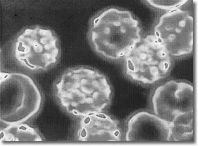 Хламидии трихомонады микоплазма. Микоплазма ферментатнс. Микоплазма гемофелис. Mycoplasma hyorhinis. Микоплазма и хламидии под микроскопом.