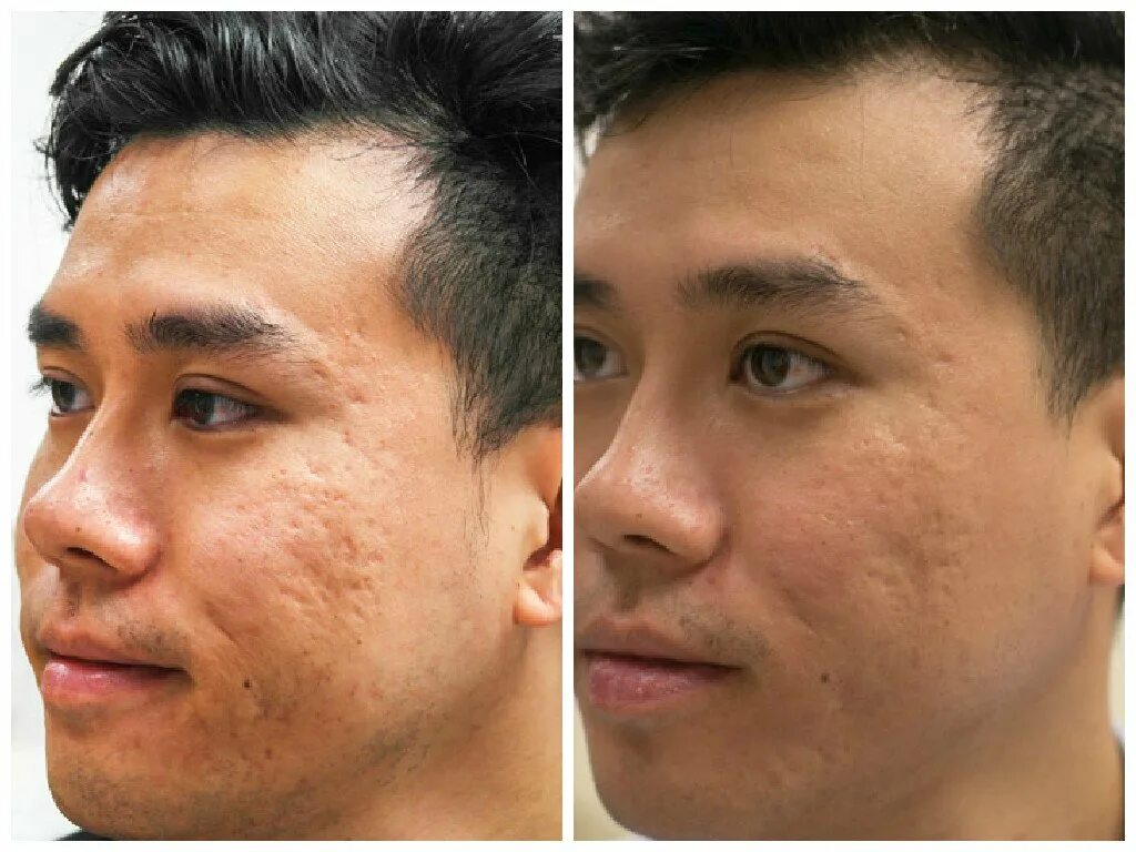 Solved face