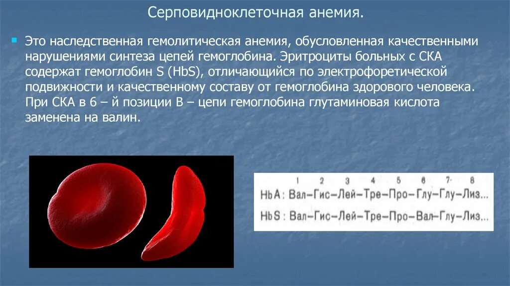 Серповидно клеточная анемия признаки. Серповидноклеточная анемия кариотип больного. Серповидная клеточная анемия гемоглобин. Серповидноклеточная анемия эритроциты. Строение гемоглобина при серповидноклеточной анемии.