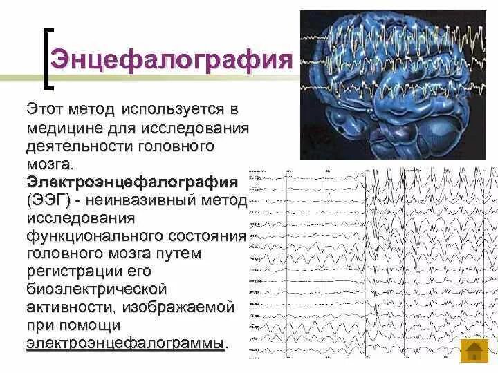 Биоэлектрическая активность коры. ЭЭГ головного мозга методика проведения. Функциональные пробы ЭЭГ. Биоэлектрическая активность головного мозга. Ритмы ЭЭГ.. ЭЭГ описание метода.