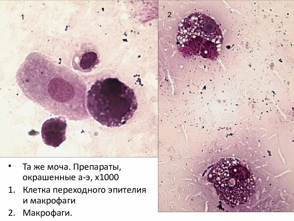 Макрофаги препарат. Альвеолярные макрофаги. Макрофаги гистология. Пенистые макрофаги гистология. Фагоциты микроскопия.