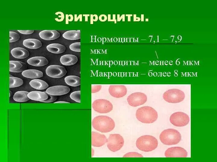 Макроциты и микроциты
