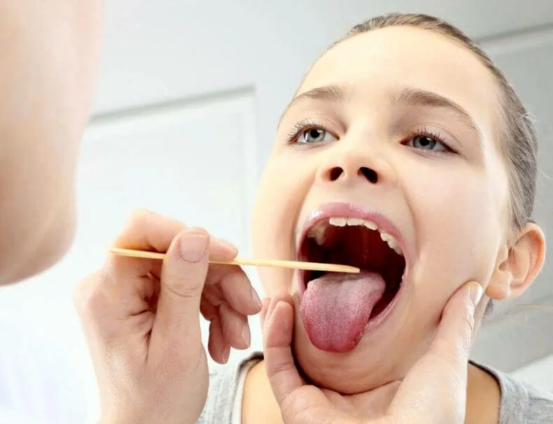 Как облегчить ребенку ангину. Дети грудного возраста. Как быстро вылечить ангину у ребенка. Аденоидаденоиды у детей. Ангина у детей информация.