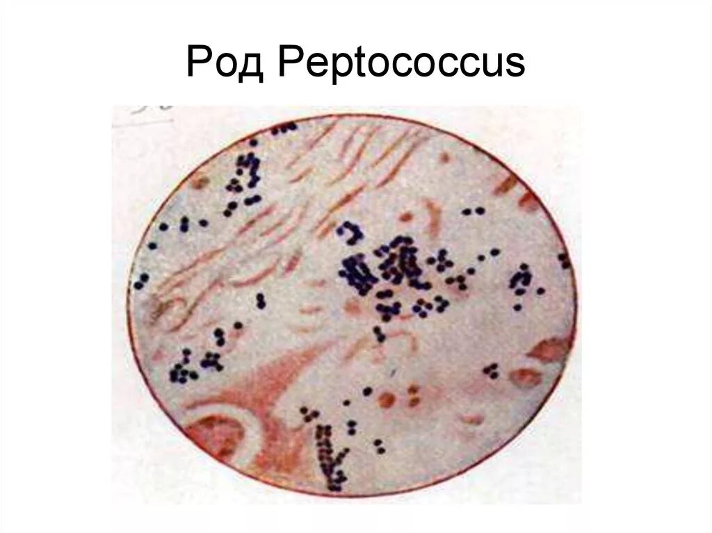 Peptostreptococcus spp