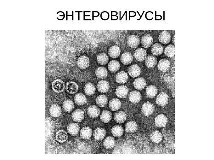 После энтеровируса