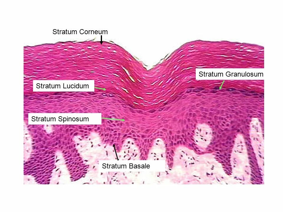 Stratum перевод. Stratum spinosum. stratum granulosum. stratum granulosum особенности. каковы особенности stratum granulosum.