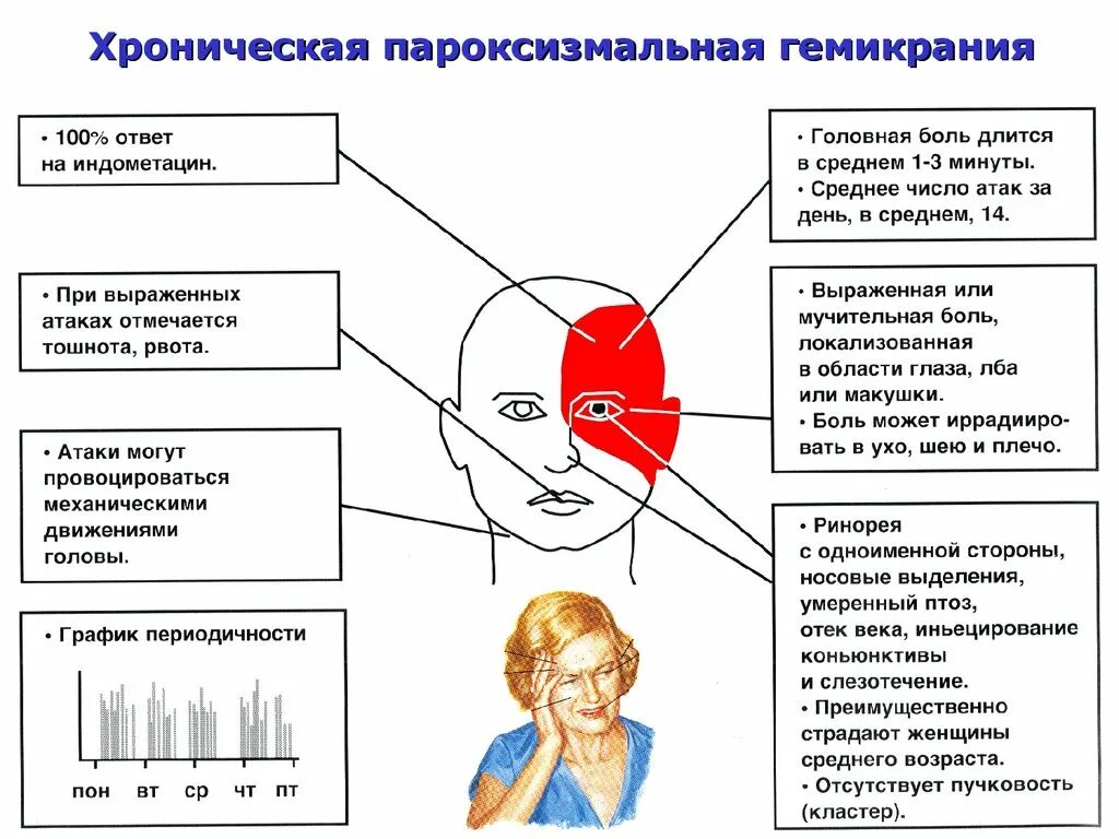 Первая помощь при головной боли. Хроническая пароксизмальная гемикрания. Головная боль. Головная боль локализация. Хроническая головная боль напряжения.