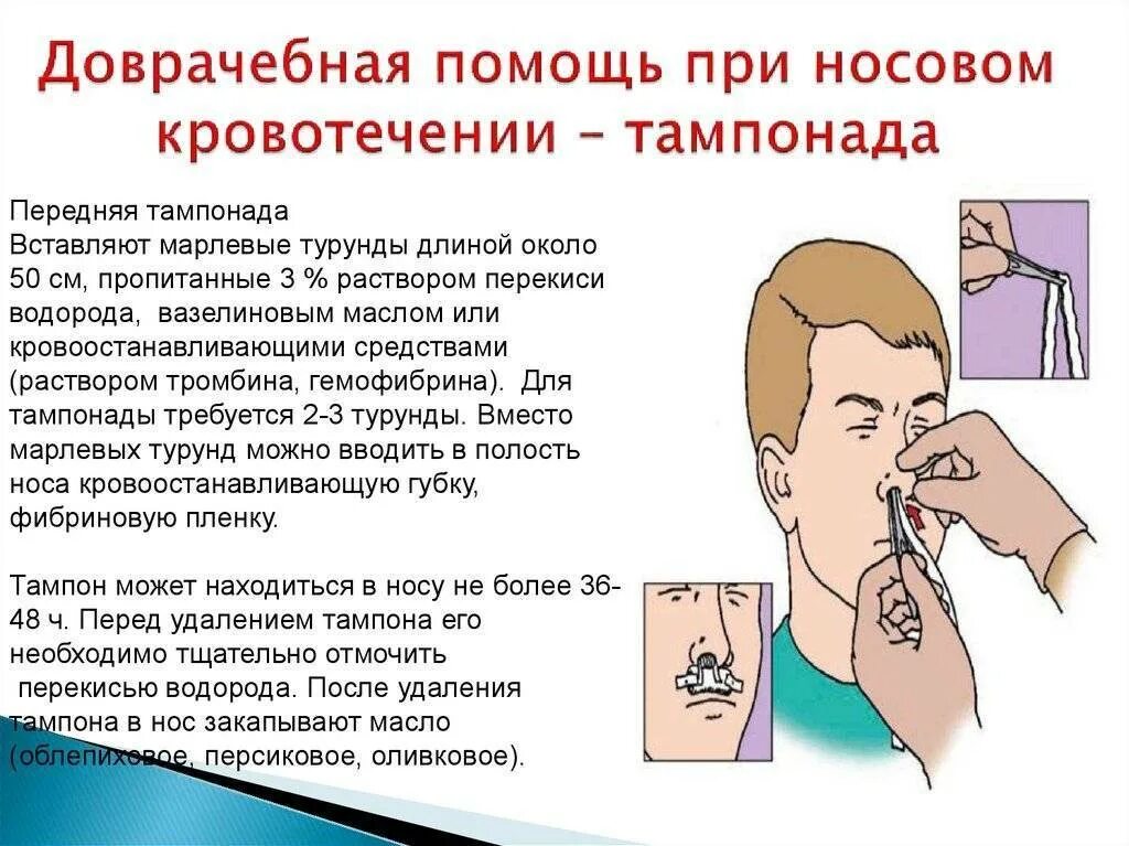 Почему постоянно текут сопли из носа как вода. Почему из носа течёт вода. Первая помощь носовомом кровотечении. Почему из ноздря течет вода. Какостанововить носовое кровотечение.