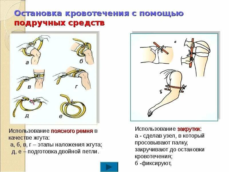 Подручные средства первой помощи. Остановка кровотечения подручными средствами. Штатные и подручные средства для остановки кровотечения. Табельные и подручные средства остановки кровотечения. Подручные средства медицинской помощи