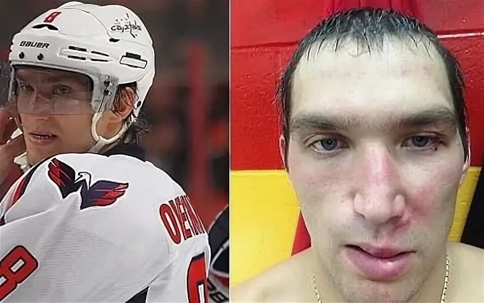 Лицо шайба